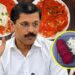 FDAच्या कडक कारवाईचा परिणाम; चायनीजमध्ये लाल रंगासाठी आता बीट आणि काश्मिरी मिरचीचा वापर